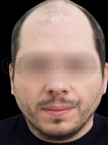 INICIAL